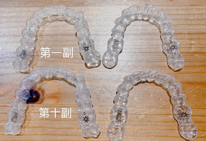 三、正雅隐形矫正系列对比与适用场景