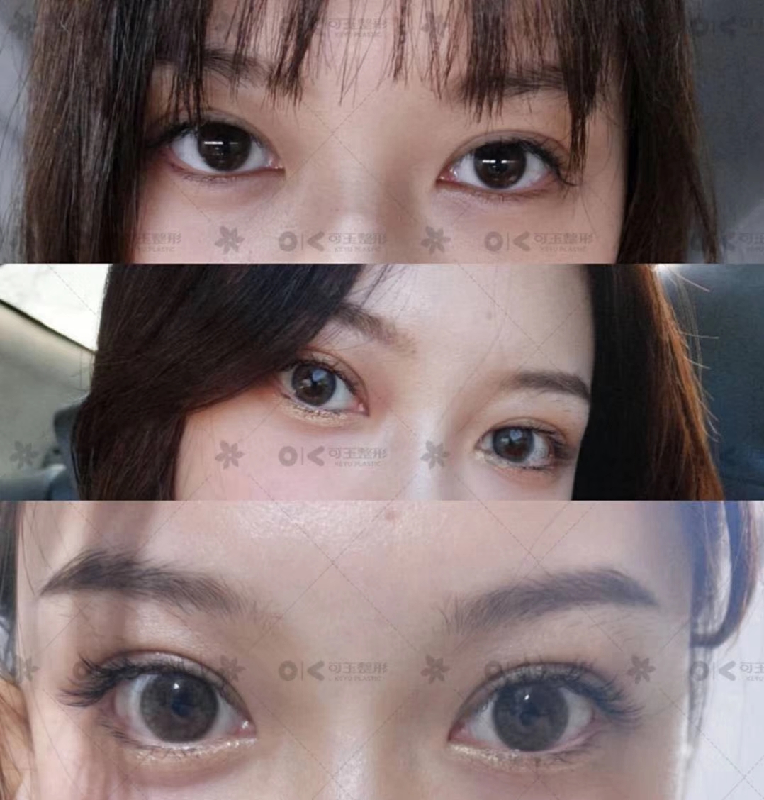 五、广州可玉医疗美容医院