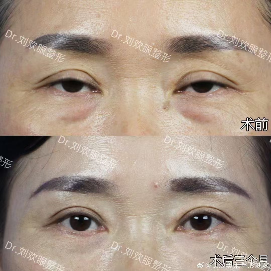 四、长沙美莱整形