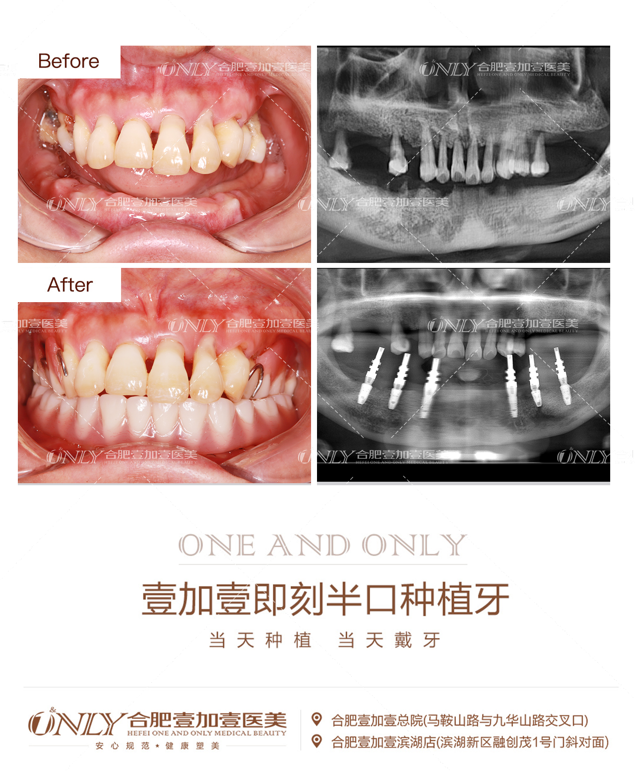 四、合肥壹加壹美容医院