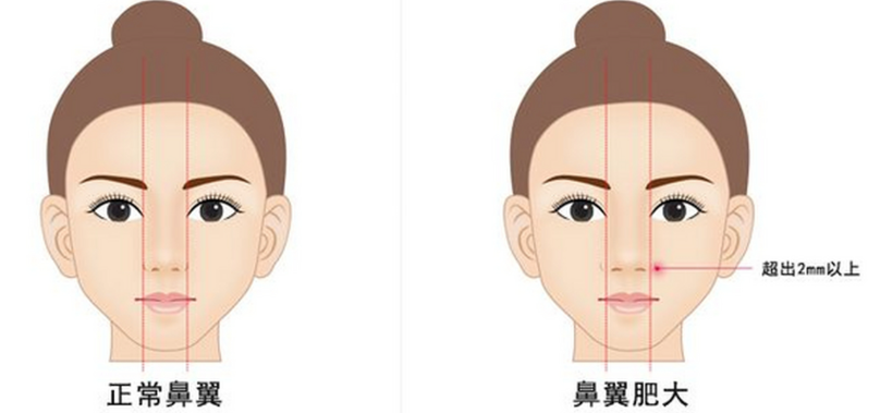 四、杨万忠和陈天杰赵博那个做鼻子比较好？术后疗效与用户反馈