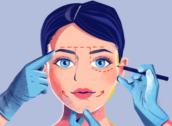 轮廓固定开刀吗？术后需戴头套？恢复期避坑指南