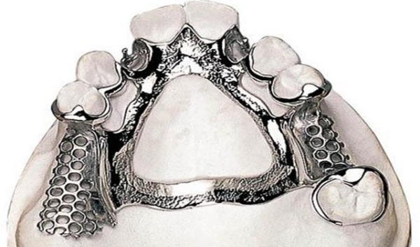 三、钝钛义齿颜色的临床应用选择