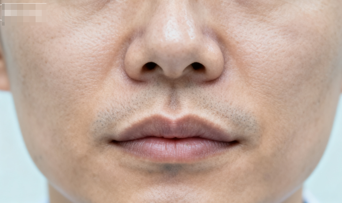 二、影响人中缩短反弹的关键因素分析