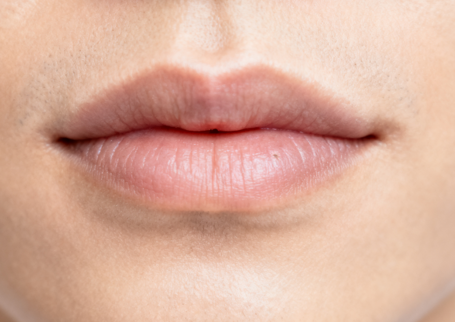 人中缩短反弹多少毫米？术后恢复期多久能自然？