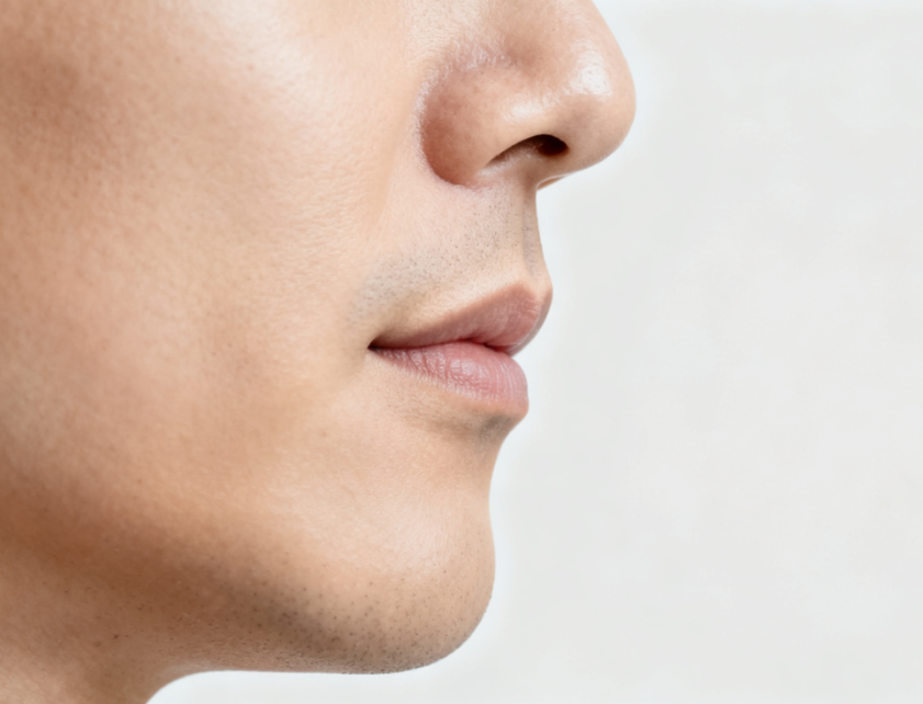 三、如何科学应对人中缩短术后反弹