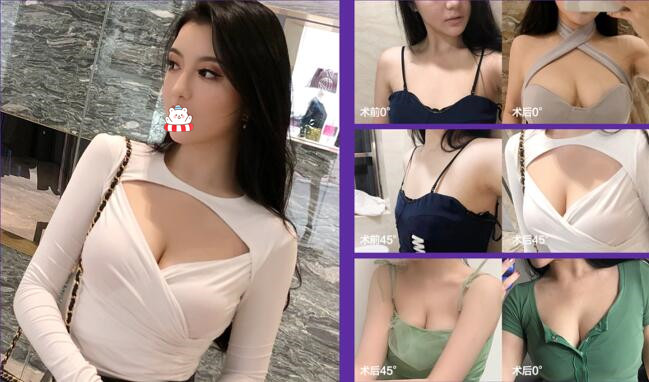 五、成都天使之翼整形医院