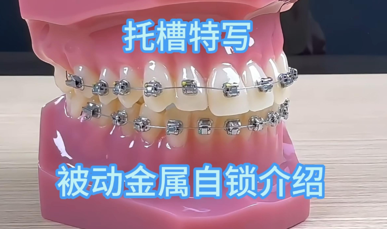 奥美科金属自锁是进口的吗？2026年最新数据：国产占比超80%