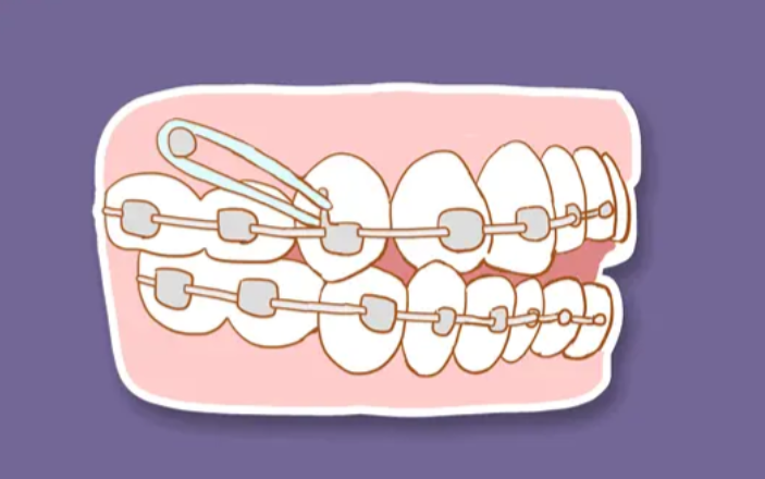 二、奥美科金属自锁是进口的吗｜价格区间与核心优势