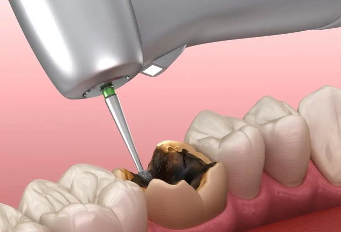 三、按医院等级划分的价格范围