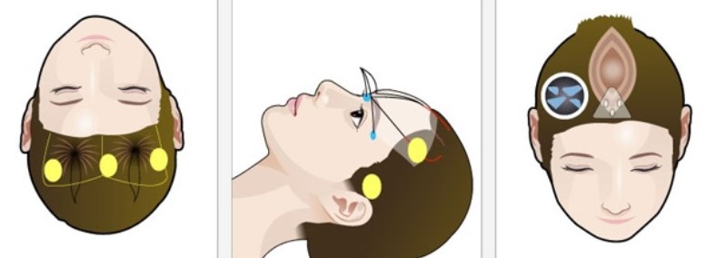 六、总结:郭玉瑞拉皮的技术优势与科学选择建议