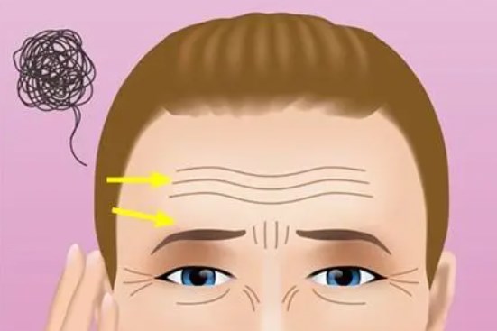 三、郭玉瑞拉皮手术风险大吗?适用人群与风险规避指南