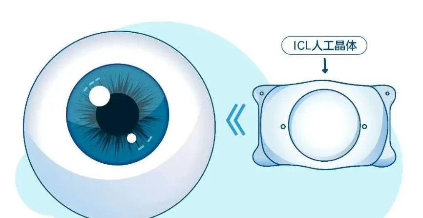 四、就诊攻略与项目要点