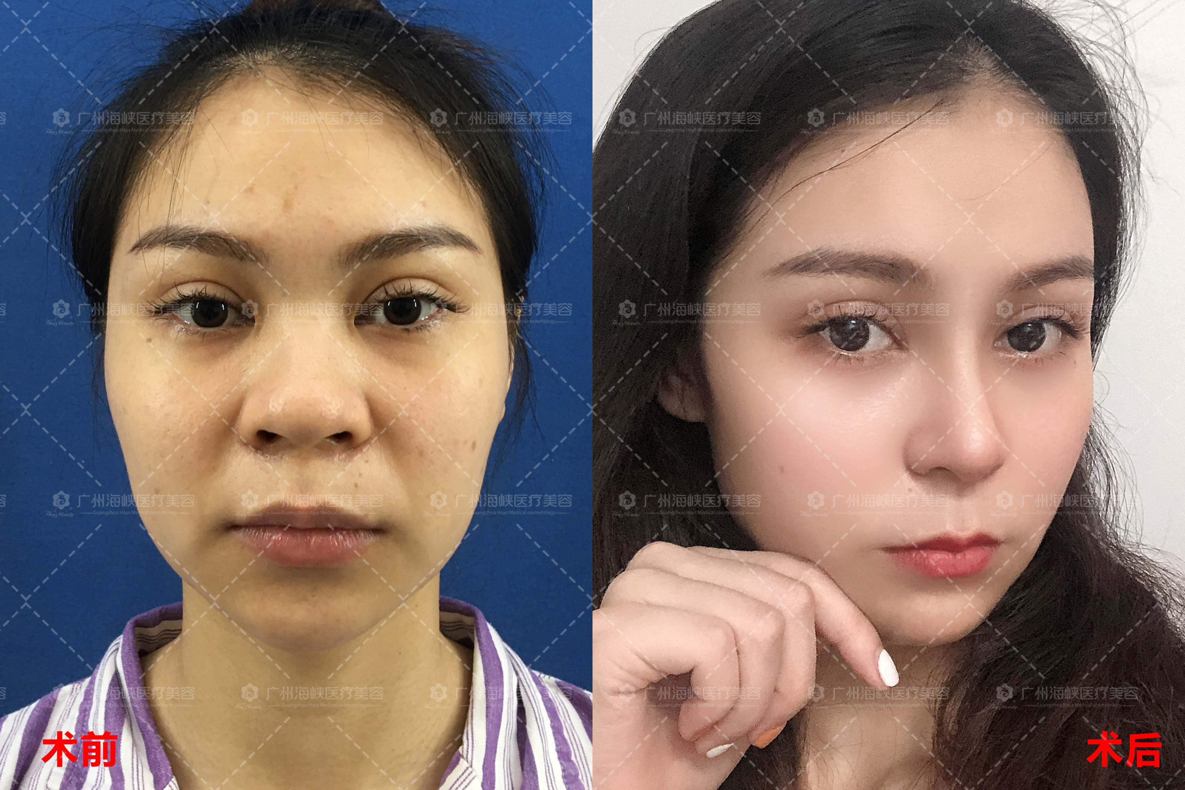 二、广州海峡医疗美容医院