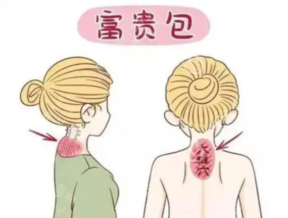 四、徐州治疗富贵包的地方真实测评：用户反馈与术后疗效对比