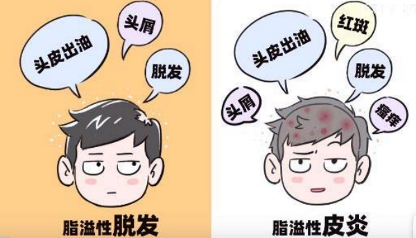 四、长治植发正规医院哪家能做不剃发?技术原理与适用场景