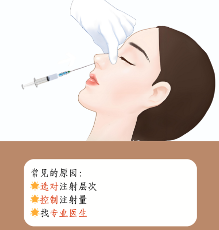 为什么不要注射隆鼻？2026年数据揭秘玻尿酸风险与修复成本超预期