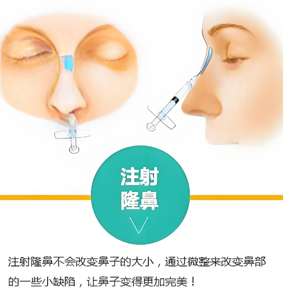 四、注射隆鼻与手术隆鼻的对比分析
