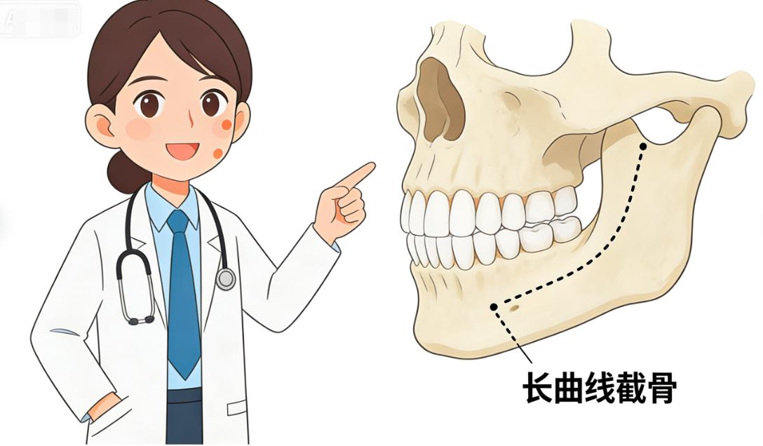 四、黄大勇磨骨手术术后护理：关键步骤与常见误区