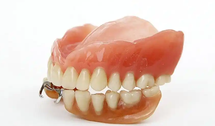 二、吸附性义齿和普通义齿区别：适用人群对比