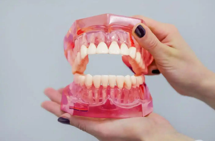 四、吸附性义齿和普通义齿区别：价格与维护成本对比