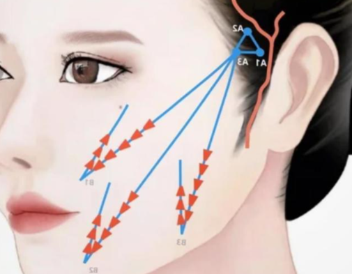 二、注射技术决定苹果肌形态稳定性
